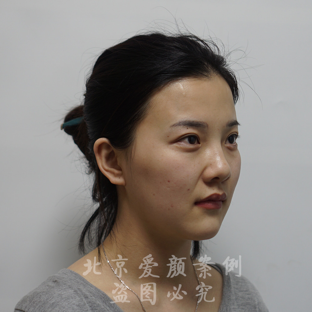 火狐电竞官方网站